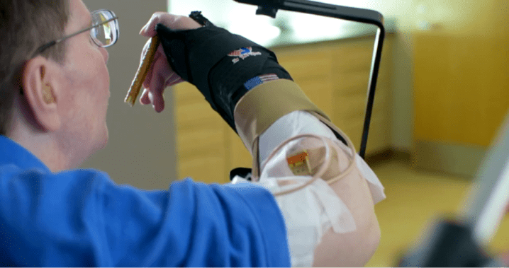 Figure 1. A tool to restore reaching and grasping functions in tetraplegia patients.