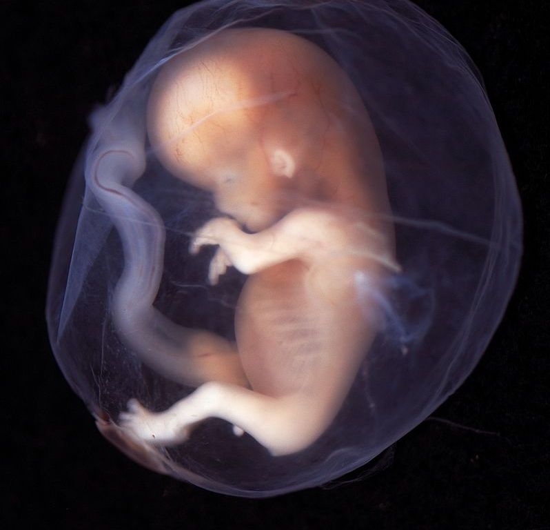 Figure 1: Fetus at 9-10 weeks estimated gestational age (EGA)