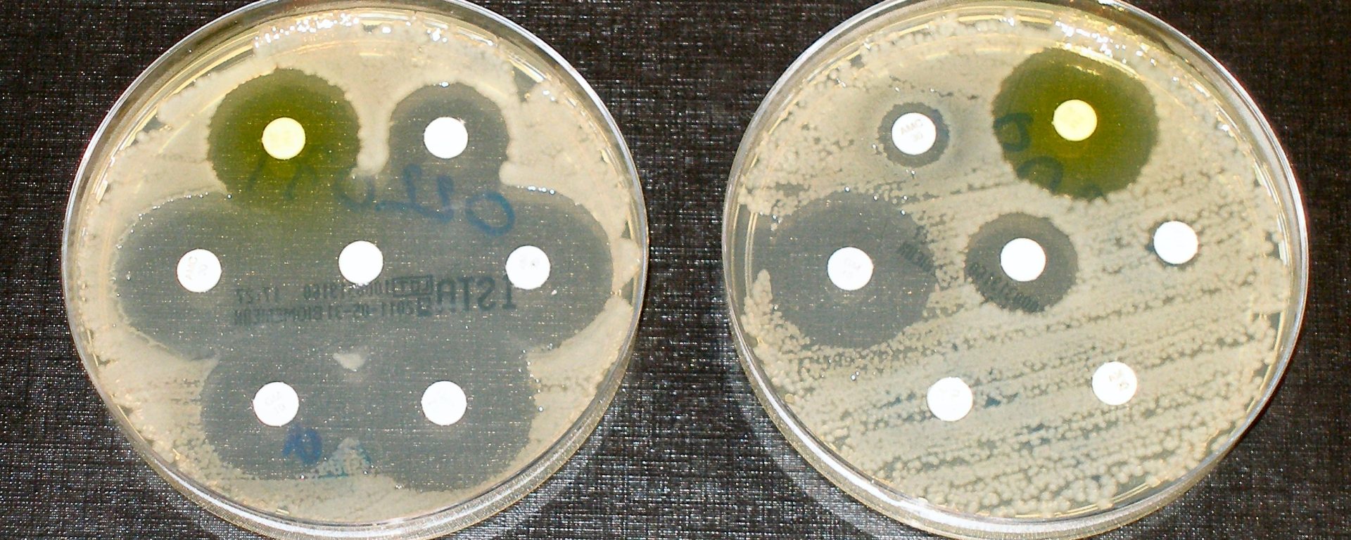 Figure 1. Researchers investigate a new way of preventing the spread of antibiotic resistant genes among bacteria to slow their rapid increase.