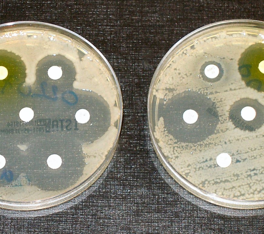 Figure 1. Researchers investigate a new way of preventing the spread of antibiotic resistant genes among bacteria to slow their rapid increase.