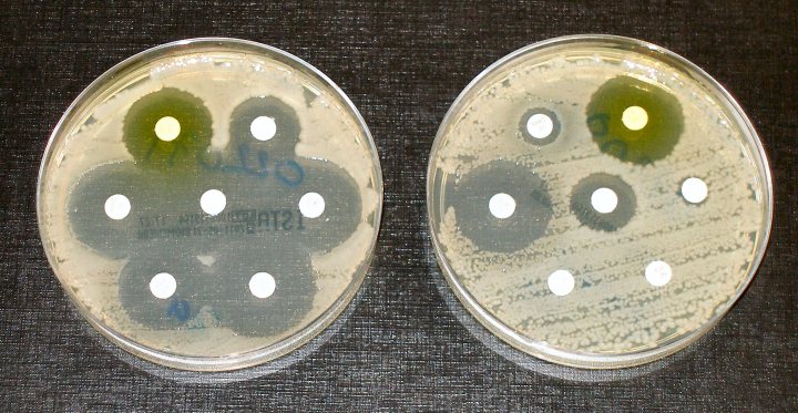 Figure 1. Researchers investigate a new way of preventing the spread of antibiotic resistant genes among bacteria to slow their rapid increase.