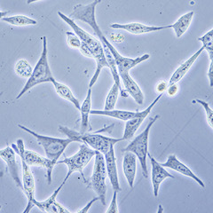 Fibroblasts