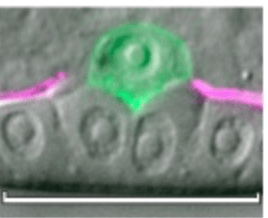 Anchor cell invasion